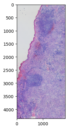 _images/Crop_ROI_Boundary_image_84_0.png